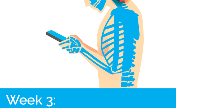 Postural Stress image